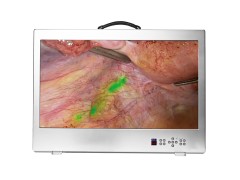 32-inch 4K UHD Fluorecent Endoscope All-in-one Camera System