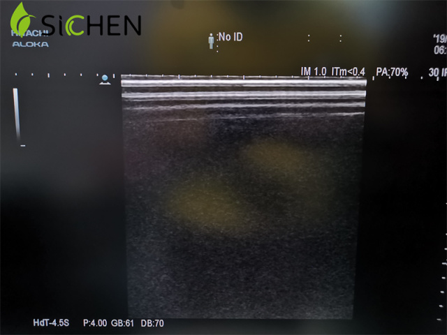 Hitachi Medical Instrument L441 3D/4D Linear Array Ultrasound Transducer/Probe
