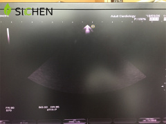 Hitachi EUP-S70 Phased Array Imaging Center Device Ultrasound Transducer/Probe