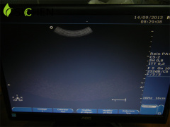 Philips Medical Imaging Device ClearVue C5-2 Broadband Curved Array Ultrasound Transducer/Probe