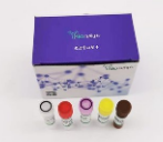 Respiratory virus quality control reagent kit