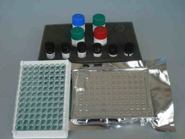 Serum/Plasma RNA/ Tissue&Cell/ Blood RNA/ FFPE RNA/ Virus RNA/ Animal RNA / Mollusc RNA/ Plant RNA/ Candida albicans RNA/ Bacterial RNA/ Algae RNA/ Staphylococcus RNA  Extraction Kit(DNase I)