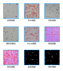 Fully automatic fluorescence cell analyzer