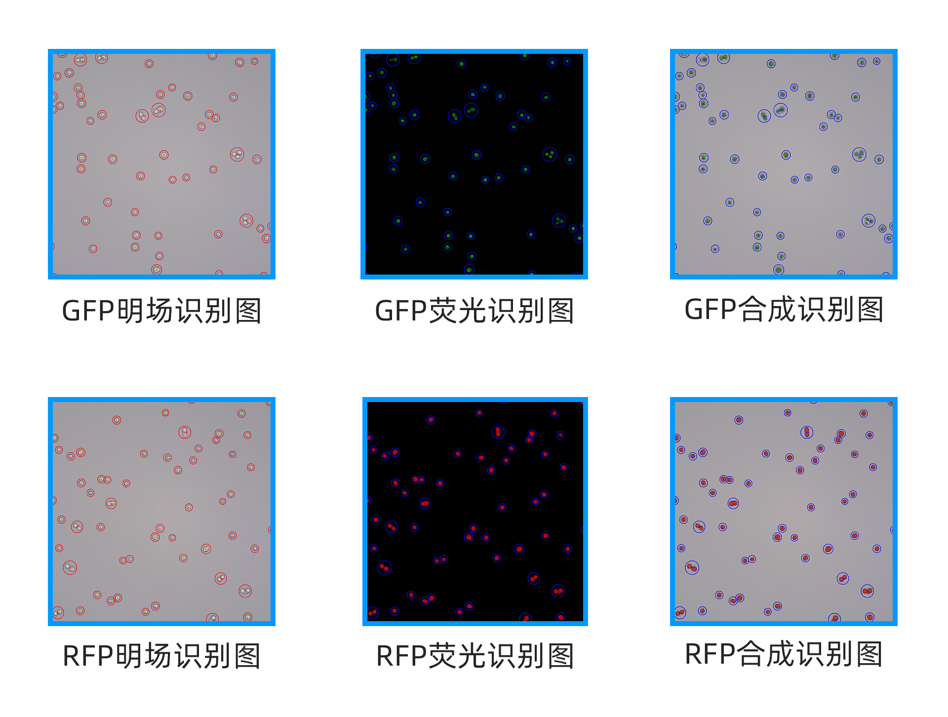 Fully automatic fluorescence cell analyzer