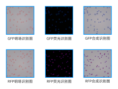 Fully automatic fluorescence cell analyzer