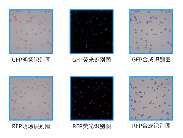 Fully automatic fluorescence cell analyzer