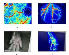 Laser speckle blood flow imager