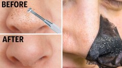 Deep Cleansing Bamboo Charcoal Nose Strips for Blackhead Removal For Men and Women