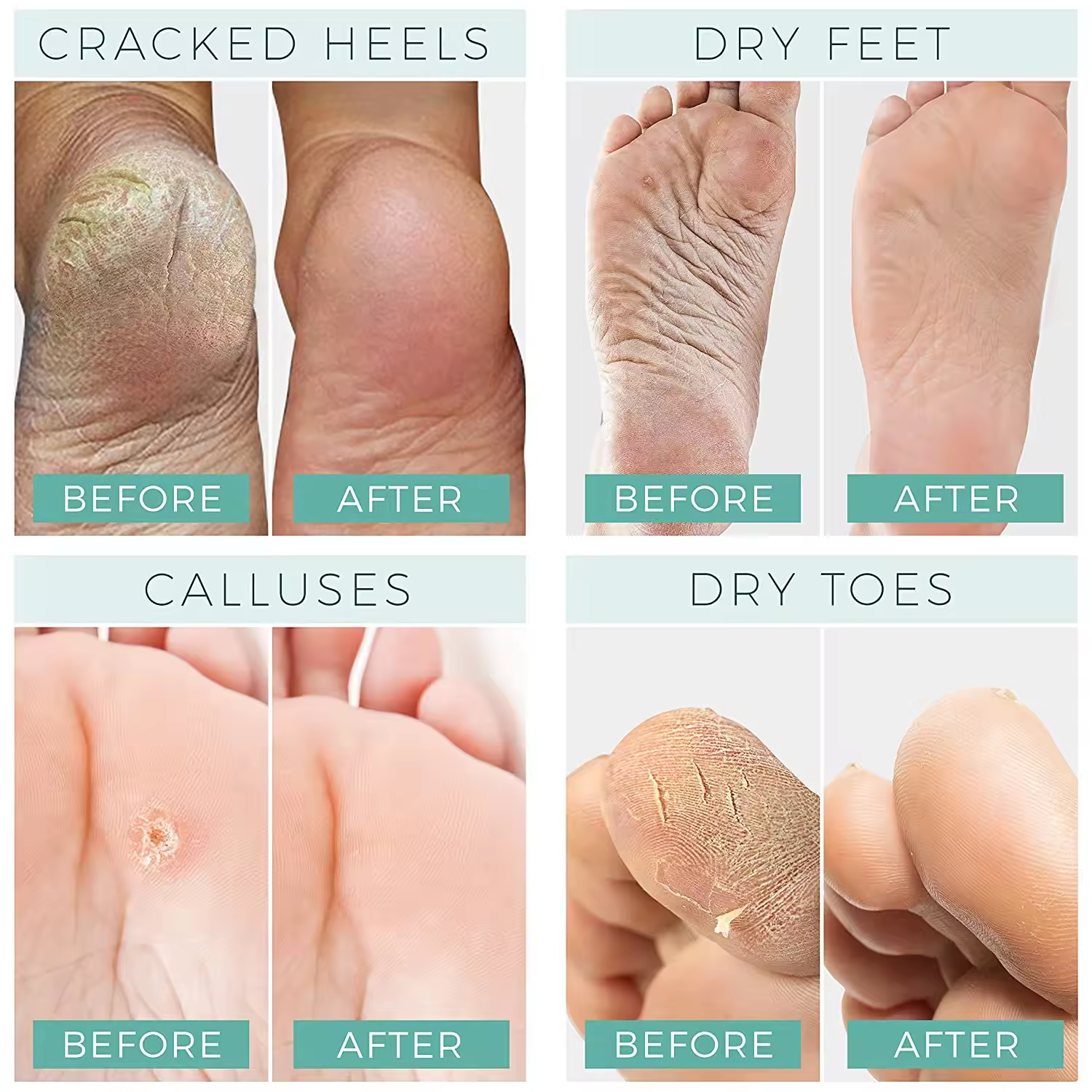Foot Mask that Moisturizes Dry Cracked Feet