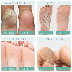 Foot Mask that Moisturizes Dry Cracked Feet