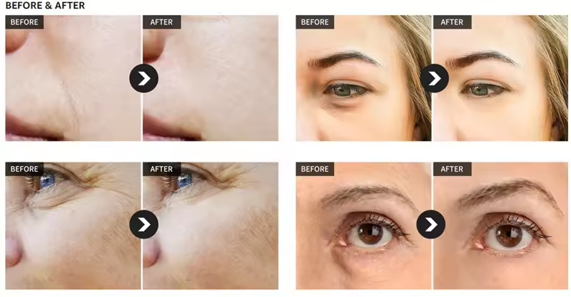 24k eye masks for dark circles and puffiness