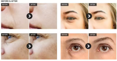 24k eye masks for dark circles and puffiness