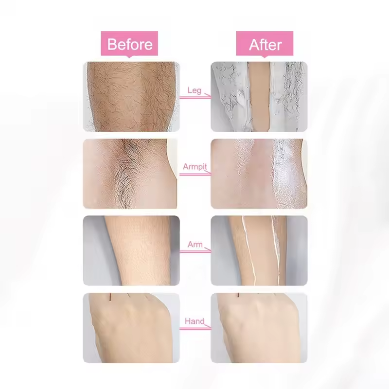 Vitamin E Hair Removal Spray Foam