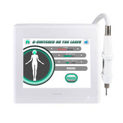 Q-switched ND YAG Laser Machine for Pigmentation Removal