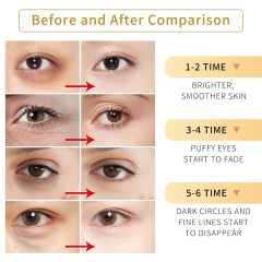 Tunbot Eye Mask - 60 Pieces - 24k Gold Eye Mask - Anti-Aging - Contains Collagen &amp; Hyaluronic Acid - Removes Dark Circles, Puffiness &amp; Wrinkles, Moisturizes - Home Skin Care