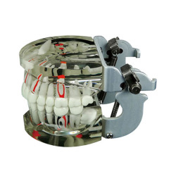 Transparent Dental Pathology Model – 28 Teeth with Implant, Caries, and Inflammation Demonstrations