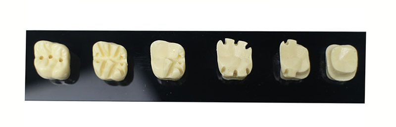 Full Crown Preparation Dental Model with Electric Handpiece