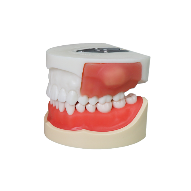 Bilateral Cystic Teeth Dental Model for Education Practice