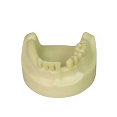 Implant Model