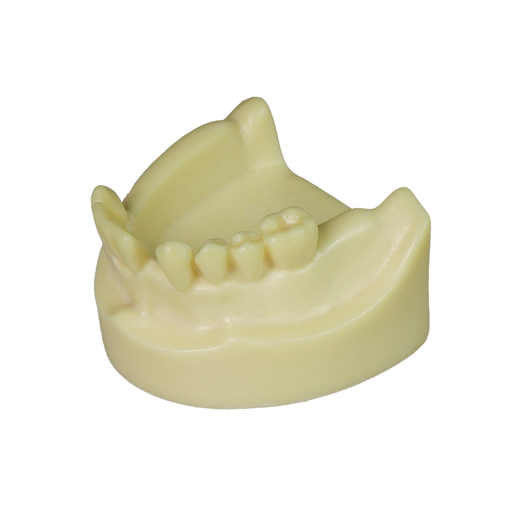 Implant Model