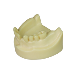 Implant Model