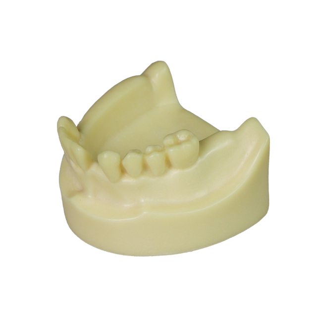 Implant Model