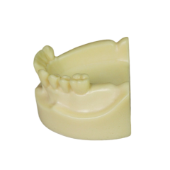 Implant Model
