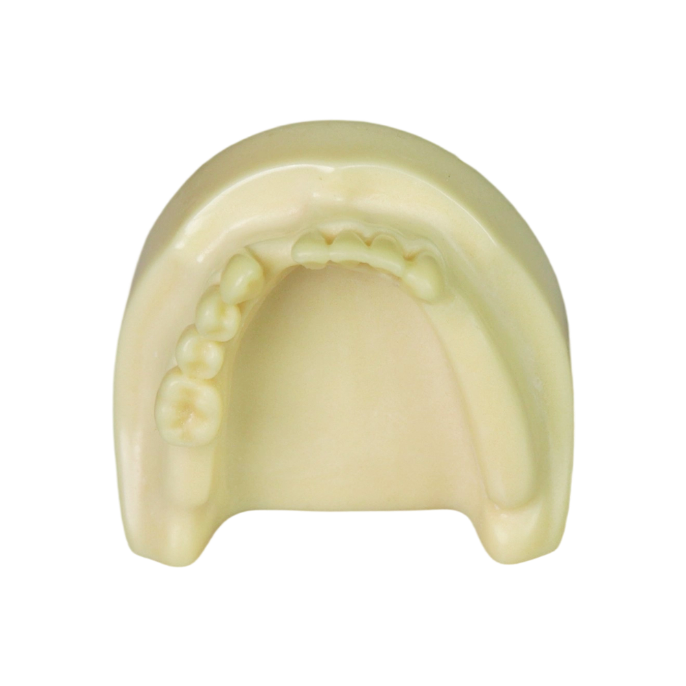 Implant Model