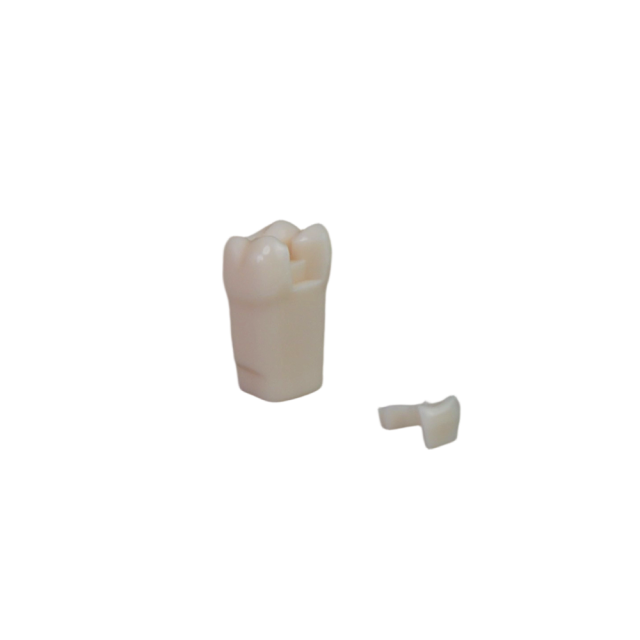 Adjacent Surface Inlay Refill Teeth for Dental Typodont | Jinglemed