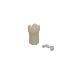 Adjacent Surface Inlay Refill Teeth for Dental Typodont | Jinglemed