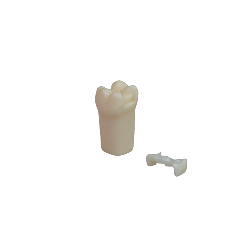 Adjacent Surface Inlay Refill Teeth for Dental Typodont | Jinglemed