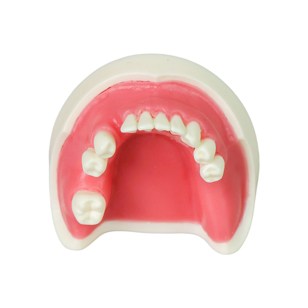 Implant Modei