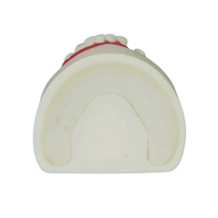 Implant Modei