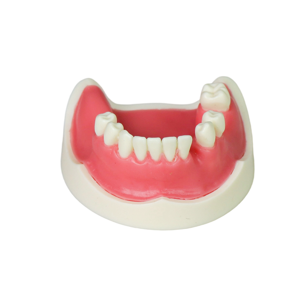 Implant Modei