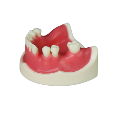Implant Modei