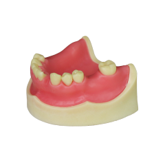 Implant Model
