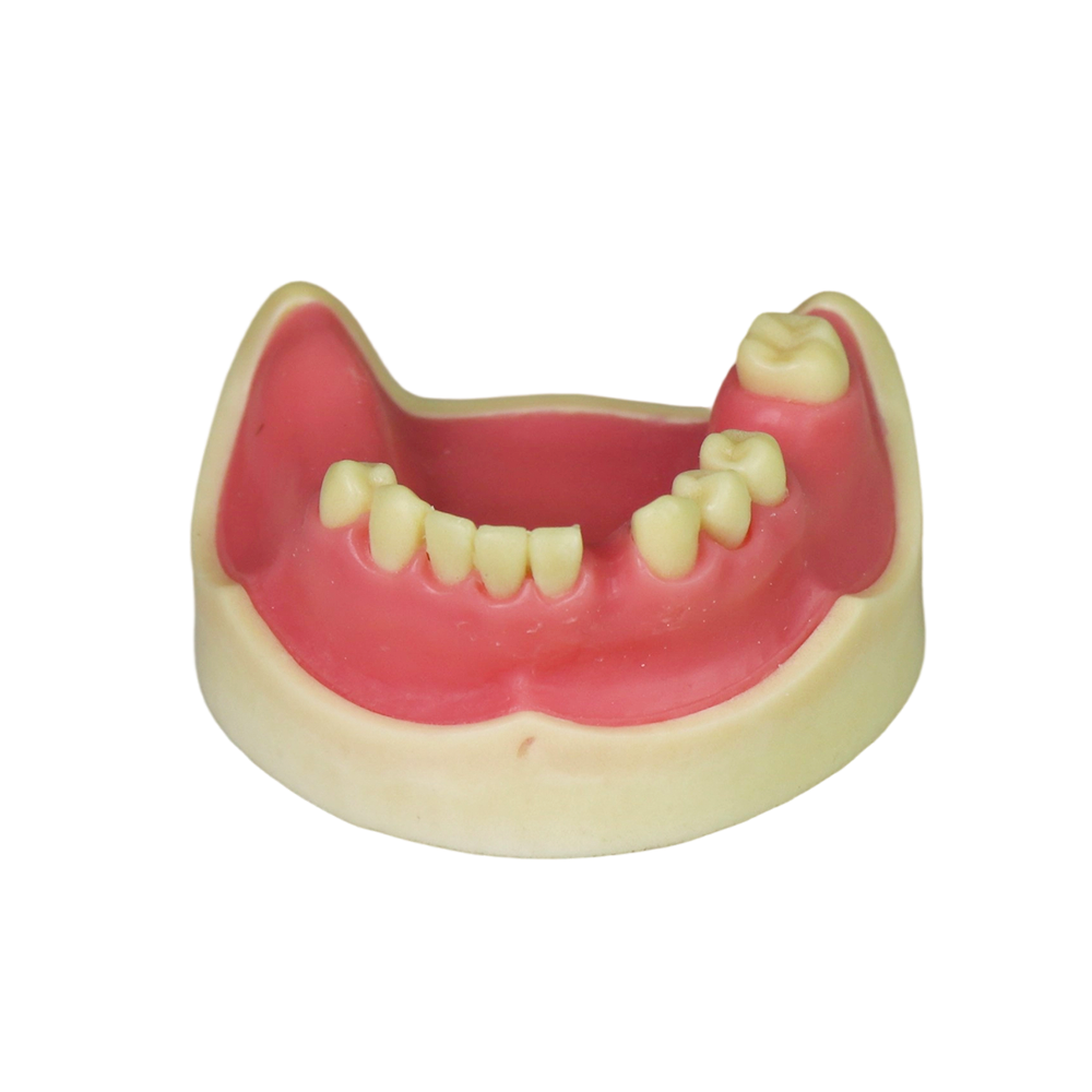 Implant Model