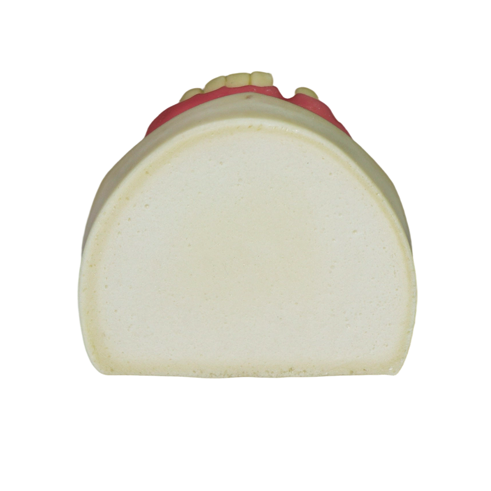 Implant Model