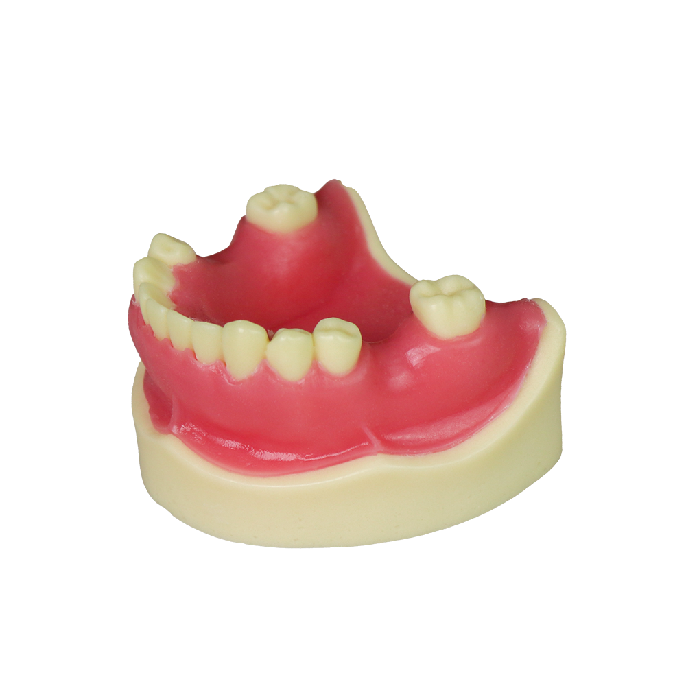 Implant Modei