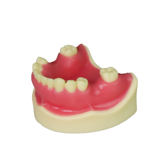 Implant Modei