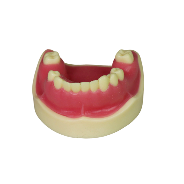 Implant Modei