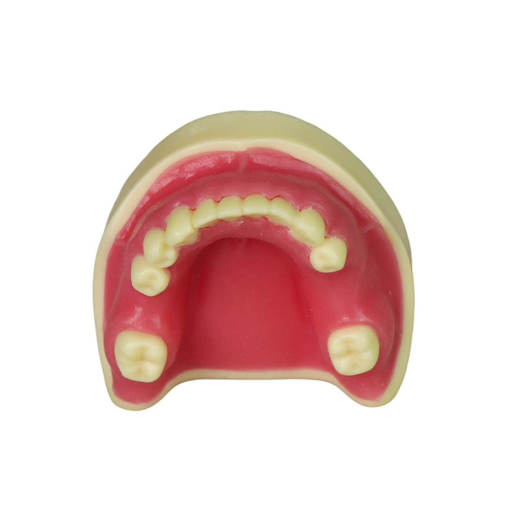 Implant Modei