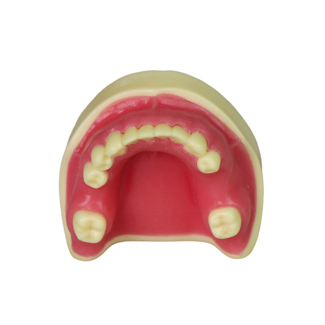 Implant Modei