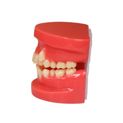 Orthodontic Demonstration Model | Malocclusion Dental Model for Patient Communication