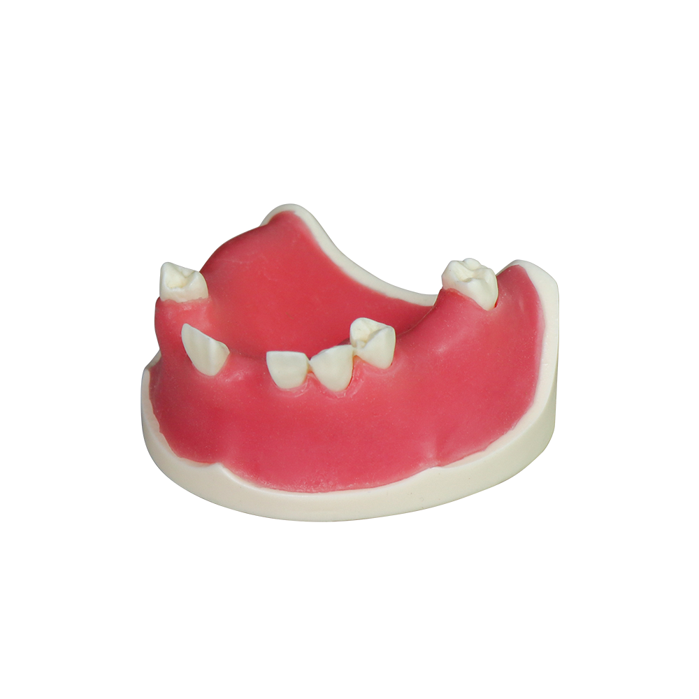 Implant Model