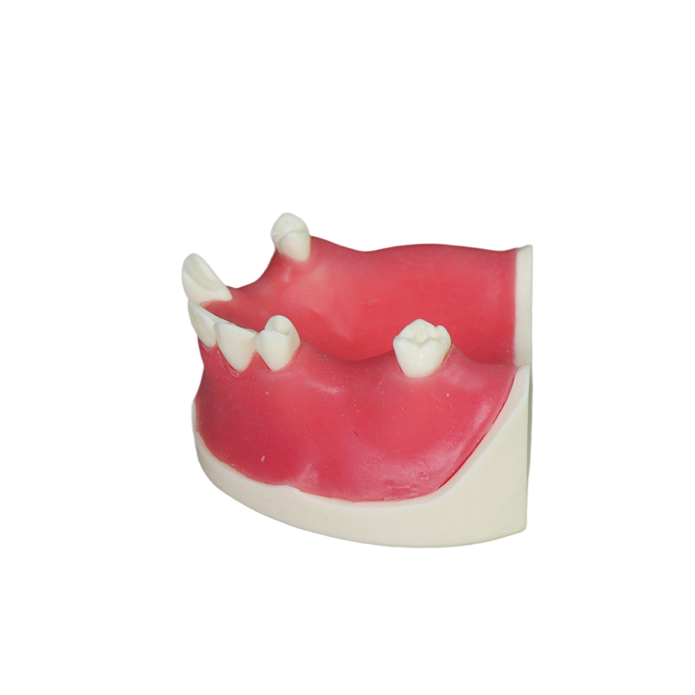 Implant Model