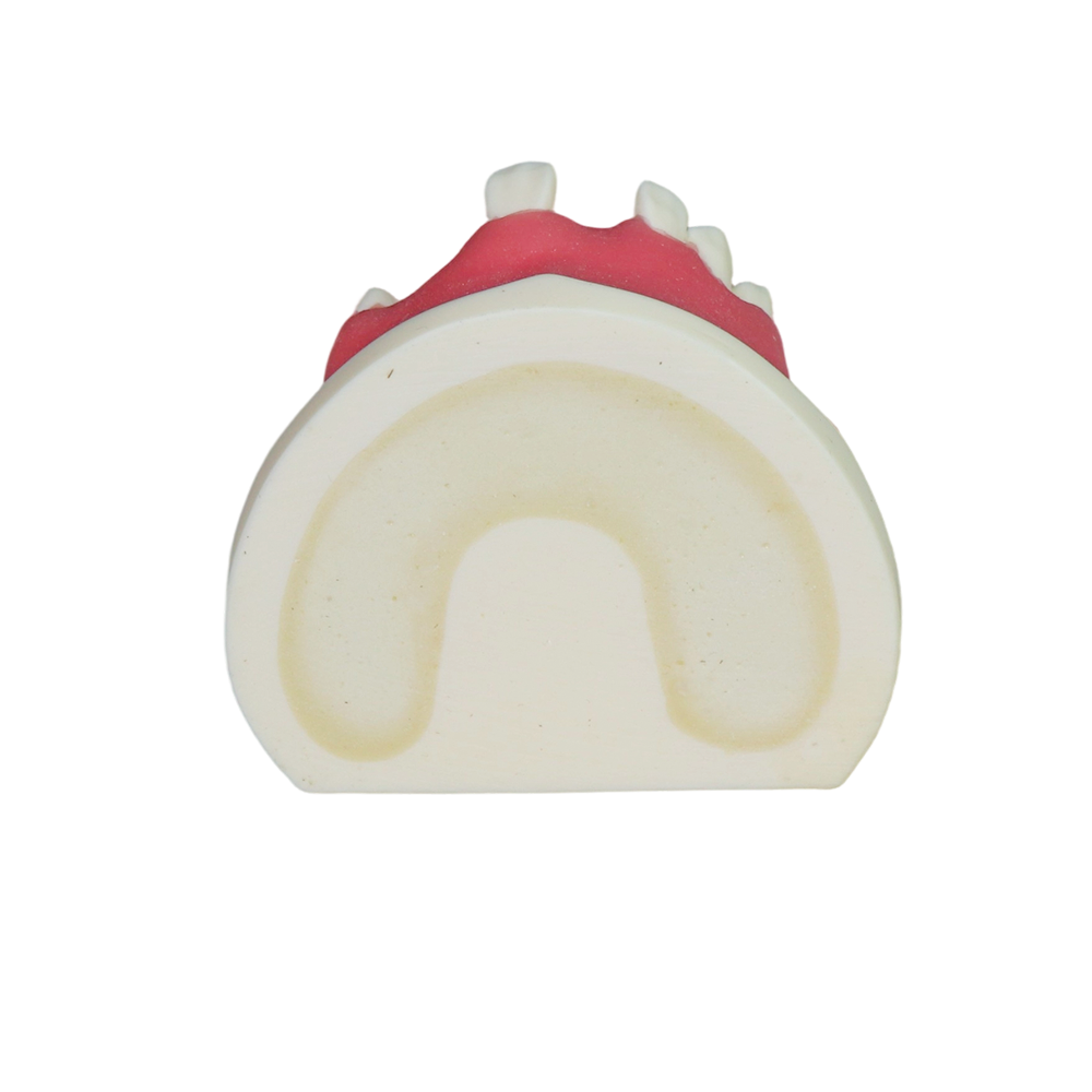 Implant Model