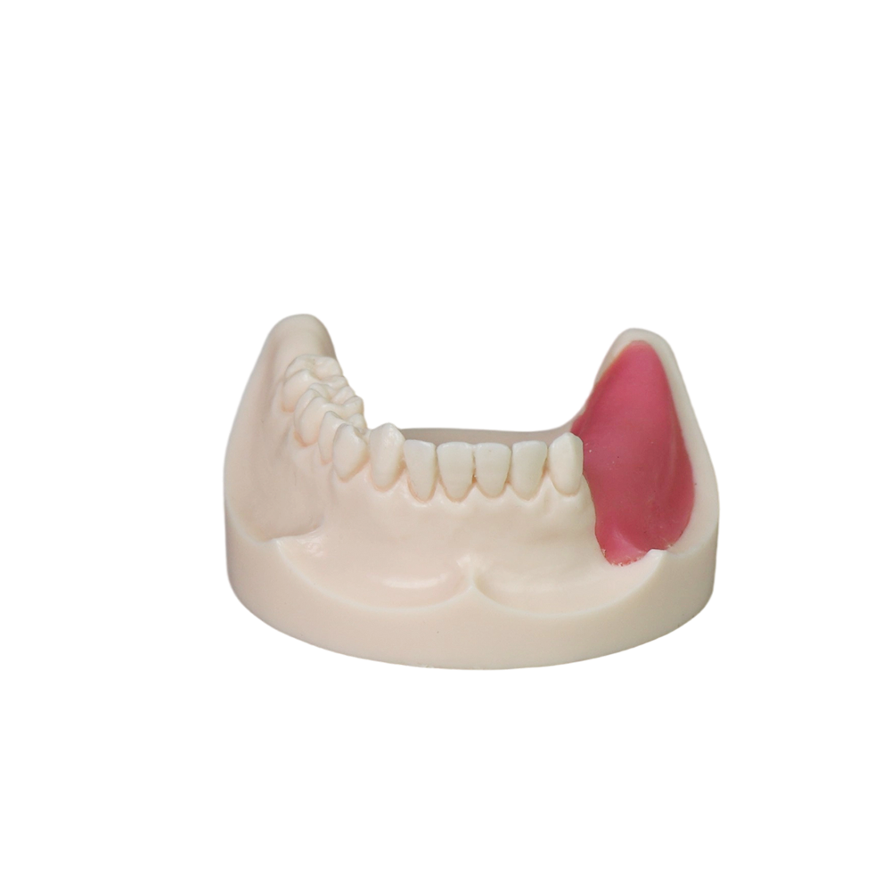 Implant Model