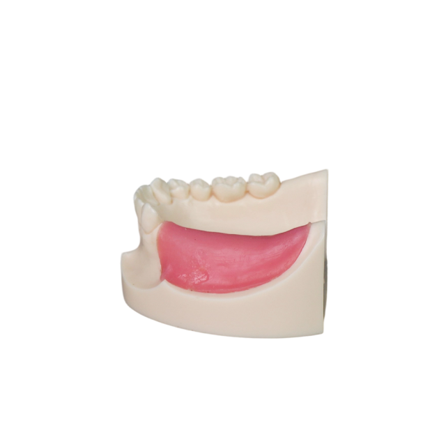 Implant Model