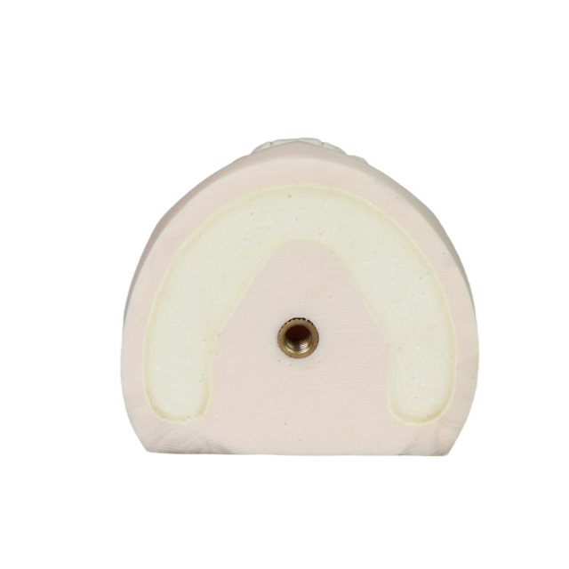 Implant Model